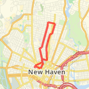 Albertus Magnus Loop